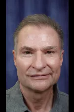 Rich Insalaco